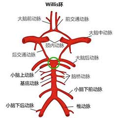經(jīng)顱多普勒（TCD）可檢測(cè)的顱內(nèi)動(dòng)脈大盤點(diǎn)！
